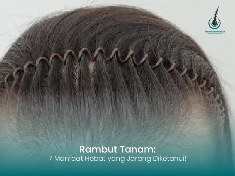 rambut-tanam