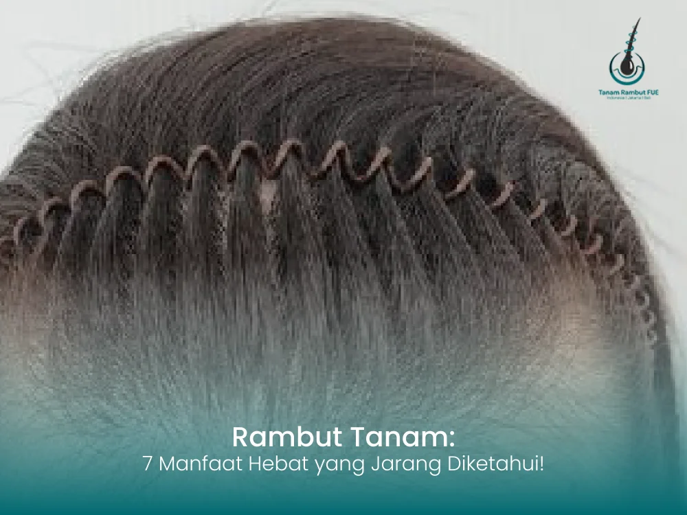 rambut-tanam