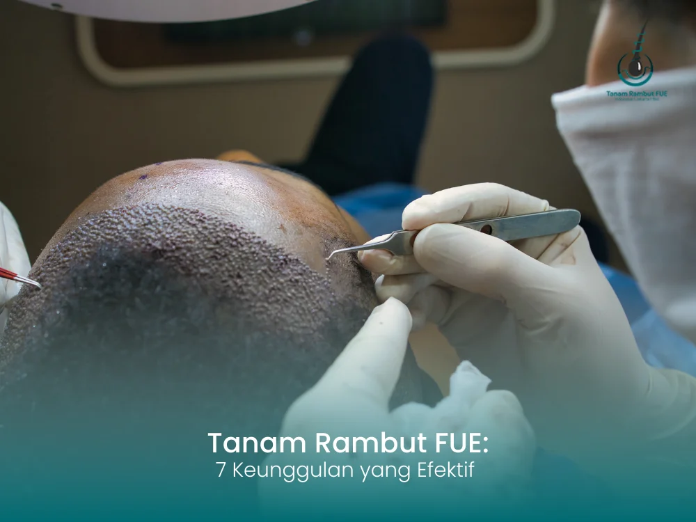 tanam-rambut-fue