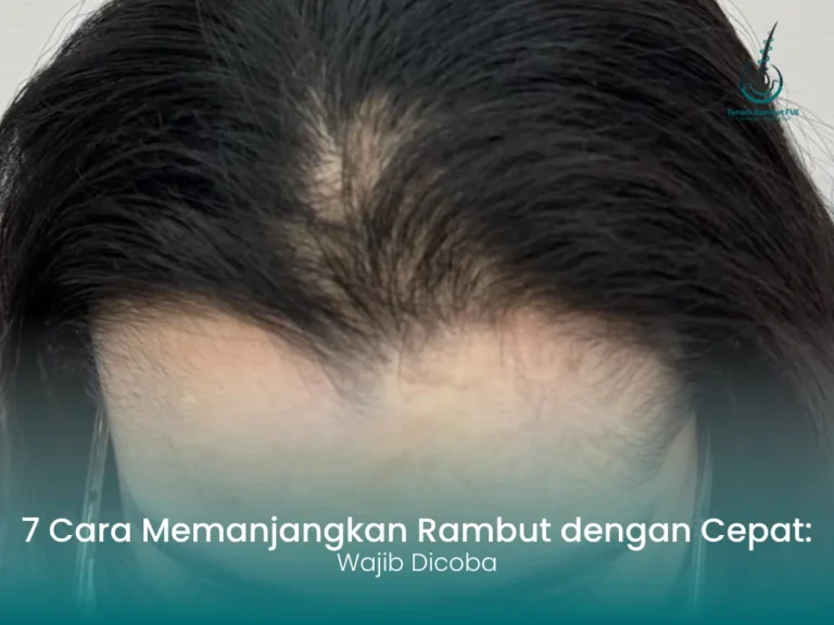 cara-memanjangkan-rambut-dengan-cepat