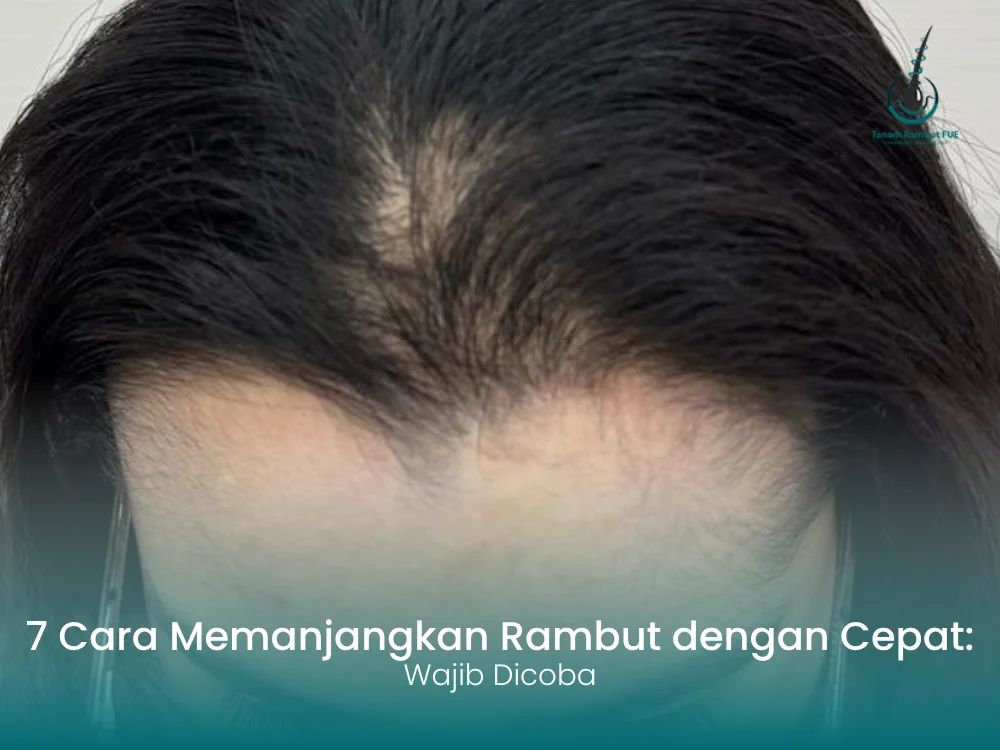 cara-memanjangkan-rambut-dengan-cepat