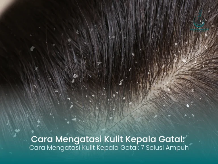 7 Solusi Ampuh Cara Mengatasi Kulit Kepala Gatal yang Mengganggu