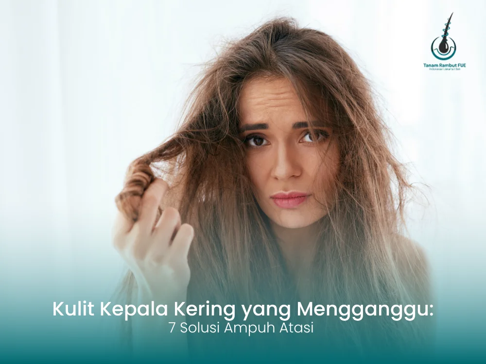 kulit-kepala-kering