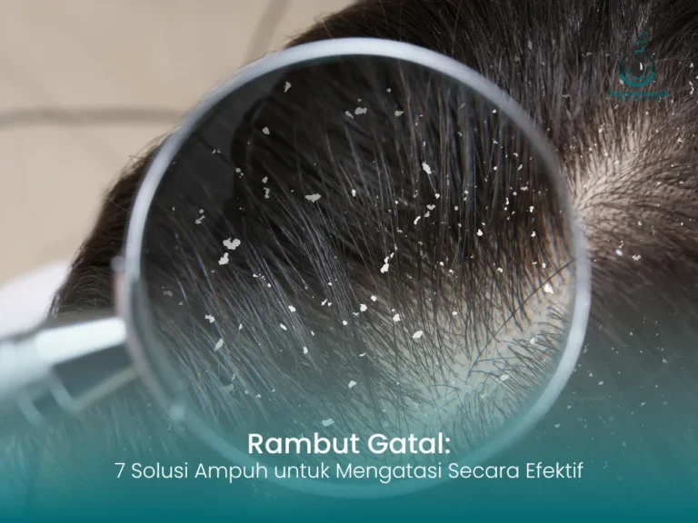 rambut-gatal-indo