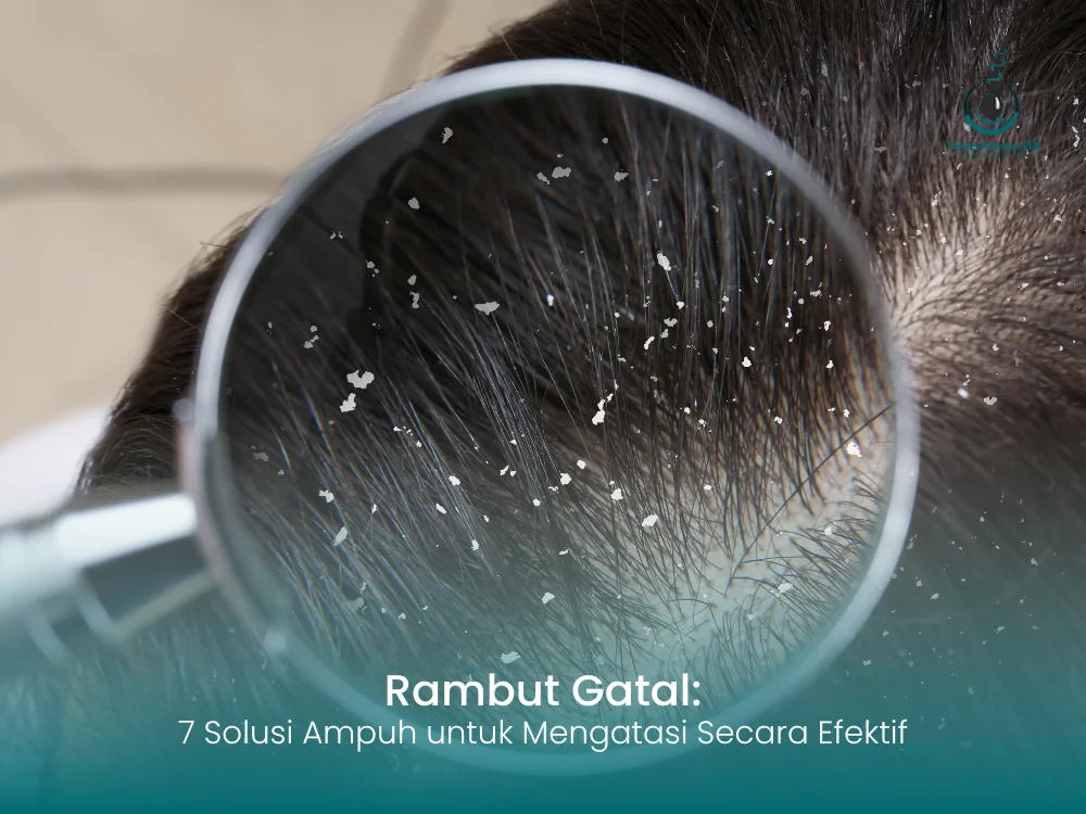 rambut-gatal-indo